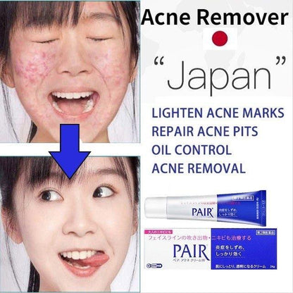 Lion Pair Acne Cream Acne Treatment Pimples Removal Cream Pair Acne Creamy Foam Facial Wash Gentle Antibacterial Blemishes Skin Repair